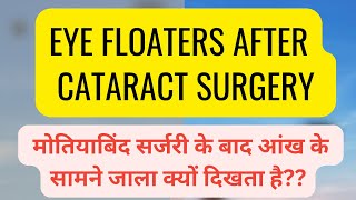 मोतियाबिंद सर्जरी के बाद आंख के सामने जाला क्यों दिखता है Floaters after cataract surgery [upl. by Khudari750]