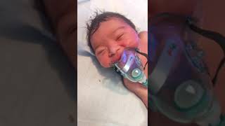 New Born baby Oxygen Attached with oxygen Mask Baby Health look Good [upl. by Ruprecht]