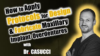 How to apply Protocols for Design and Fabricate Maxillary Implant Overdentures [upl. by Dicks]