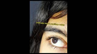 Examination of pupillary light reflex 2nd year MBBS practical Physiology [upl. by Jit590]