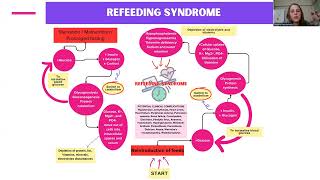 quotRefeeding syndrome in paediatric patients with severe acute malnutritionquot  Natalie Heydenrych [upl. by Eshman]