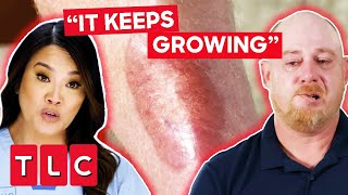 Dr Lee Helps A Terrified Dad With A Large Mark  Dr Pimple Popper This Is Zit [upl. by Eissac590]