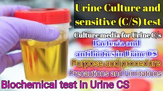 Urine Culture and Sensitivity CS test full explained [upl. by Kline]