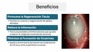 Membrana Amniotica  Dra Argeñal [upl. by Hera]