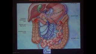 Manejo endovascular de la trombosis mesentérica [upl. by Palm708]