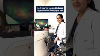 Blockages in the blood vessels of the eye  Fundus image  Dr Vishma Prabhu eyecareprofessionals [upl. by Ecirtemed]