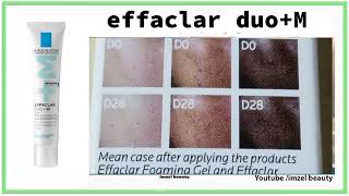 effaclar duo M 2024 منتج رائع ضد حب الشباب و اثاره و لكن ضروري من الاستعمال الصحيح [upl. by Taryn]