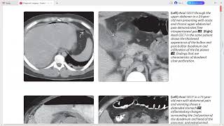 DUODENUM IMAGING DIAGNOSTIC IMAGING SERIES [upl. by Anivlem]