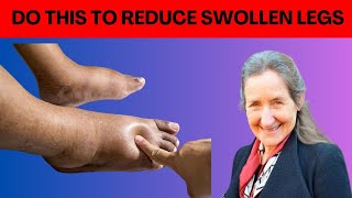 Barbara ONeills INSTANT Natural Remedies for Swollen Legs and Feet [upl. by Aible]