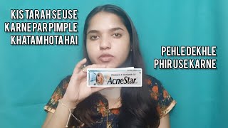 acne star gel kis tarha se use karne par pimple khatam hoeffect and side effects [upl. by Anerroc702]