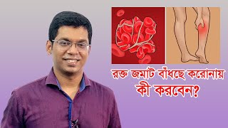 রক্ত জমাট বাঁধছে করোনায় কী করবেন DrSaklayen Russel [upl. by Disario]