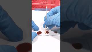 Blood typing procedure mls cls medtechstudent blood laboratory [upl. by Nnaylloh]