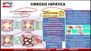 Qx gastroenterologia  CIRROSIS HEPATICA [upl. by Yelbmik]