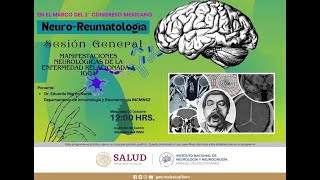 2 Congreso NeuroReumatologia quotManifestaciones Neurológicas de la enfermedad relacionada a IgG4quot [upl. by Hester]