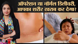 C Section Delivery से बच्चा बीमार पैदा होता है डॉक्टर ने सारे myth दूर कर दिए  Meow  Ep181 [upl. by Suhpoelc]