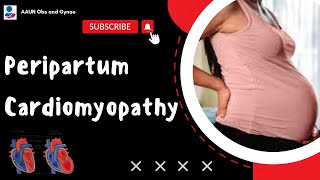 Peripartum Cardiomyopathy  TOG Article [upl. by Hoo]