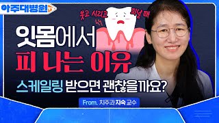 “치실은 효과가 별로 없습니다” 치주질환 예방하려면 ‘이것’을 쓰세요 🚨잇몸에서 피나는 사람 필수 시청🚨 치주과 지숙 아주대병원TV [upl. by Ahsienod]