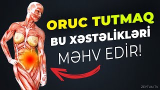 Oruc Tutmaq Bu Xəstəlikləri MƏHV EDİR  MÜTLƏQ İZLƏYİN [upl. by Ttemme]