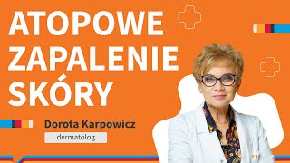 Atopowe zapalenie skóry – przyczyny objawy leczenie [upl. by Akirat]