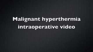 Malignant Hyperthermia Intraoperative video  Case Report [upl. by Pilihp]