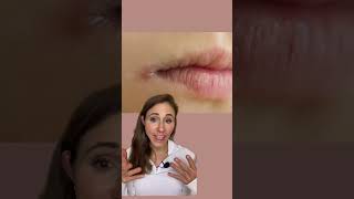 How To Get Rid Of Angular Cheilitis For Good dermatologist [upl. by Catlaina754]