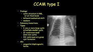 ultrasound radiologysonology [upl. by Jenn329]