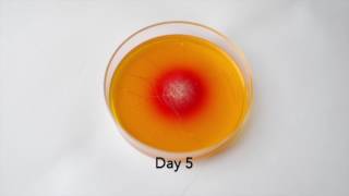 DTM Fungal Culture Growth of Ringworm [upl. by Dixil]