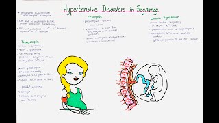 Hypertensive Disorders in Pregnancy  Preeclampsia Eclampsia Gestational Hypertension [upl. by Pellegrini]