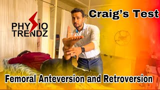 What Is Femoral Anteversion amp Retroversion and How To Test Physio trendz Physical therapy [upl. by Aienahs]