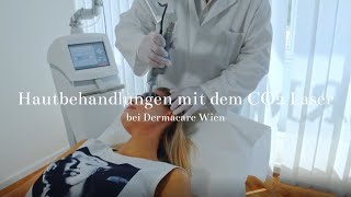 Hautbehandlungen mit dem CO2 Laser bei Dermacare Wien [upl. by Clint952]