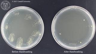 Bacteria before and after washing hands [upl. by Tewfik]