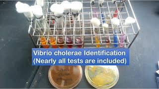 Vibrio cholerae identification  A to Z tests [upl. by Kiefer539]