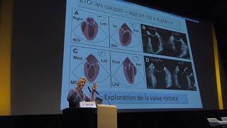 Avantages de lEchographie TransOesophagienne ETO  Dr YVAN PHILIP [upl. by Eberly]