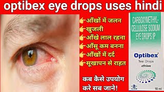 carboxymethylcellulose sodium eye drops  optibex tear eye drops Uses in Hindi [upl. by Lissie]