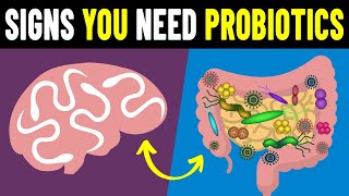 9 Signs You Need To Take Probiotics [upl. by Sena]