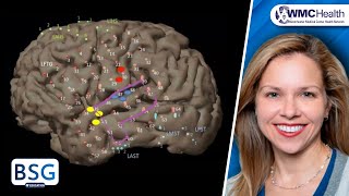 Temporal Lobe Epilepsy Seminar 1 Overview [upl. by Uhej]