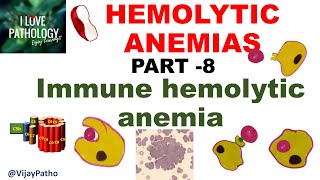 Hemolytic Anemias Part 8 Immune Hemolytic Anemia IHA [upl. by Eben]