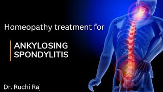 HOMEOPATHY TREATMENT FOR ANKYLOSING SPONDYLITIS [upl. by Gonroff]