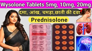 Prednisolone dispersible tablets 10 mg  wysolone 5 mg tablet uses in hindi  wysolone 10 mg hindi [upl. by Beall]