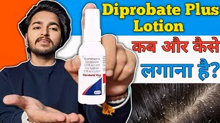 Diprobate Plus Lotion Detailed Review  How to Use Diprobate Plus Lotion [upl. by Ayatnahs]