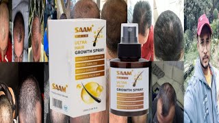 Saam Ultra Hair Growth Spray  Honest Review [upl. by Yleve655]