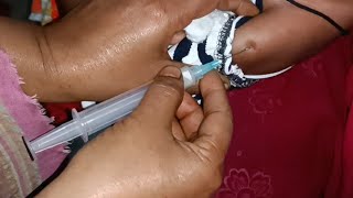 Child Cefepime 500mg Ultraprime amp Flucloxin injection Video 24 Ep 111 Injection Tips [upl. by Esinned]