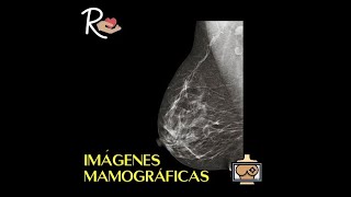 Imágenes Mamográficas ¿Qué se ve cuando te hacen una Mamografía Serie de la Mamografía 68 [upl. by Ayikur]