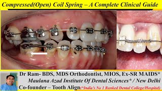 How to Use CompressedOpen Coil Spring A Complete Clinical Guide Fixed OrthodonticsBraces Dr Ram [upl. by Ellehciram]