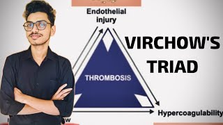 What is Virchows Triad Pathology Haemodynamics 60sec pathology medicalstudentshortsscience [upl. by Oicul]