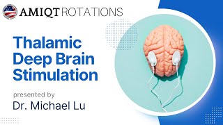 Michael Lu Thalamic Deep Brain Stimulation for Closed Head injury [upl. by Hatokad]