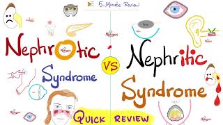 Nephrotic AND Nephritic Syndrome  Quick Review  Nephrology amp Pathology [upl. by Atinek]