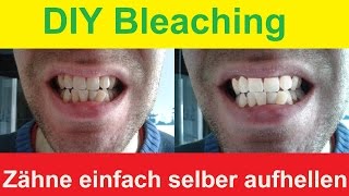 Zähne zu Hause selber bleichen  DIY Bleaching  Zähne aufhellen mit Backpulver [upl. by Consuela661]