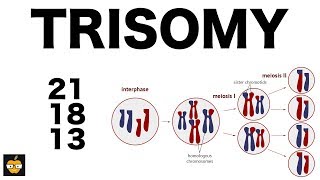 Trisomy 21 18 and 13 amp Nondisjunction Genetics [upl. by Akit]