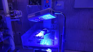 Phototherapy Treatment For Jaundice  Phototherapy In Newborn [upl. by Bentlee719]